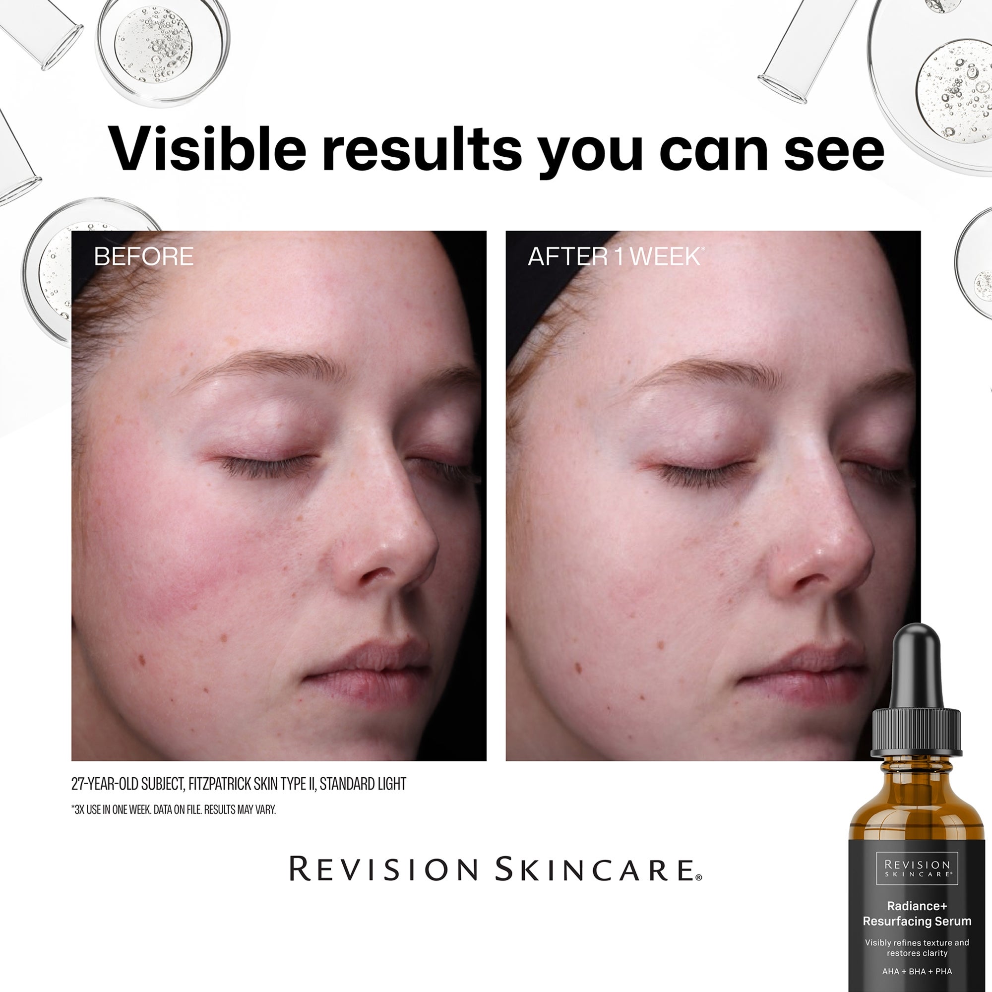 Revision Skincare Radiance+ Resurfacing Serum (1.0 fl. oz