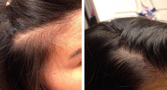Grow Gorgeous Hair Growth Serum Results