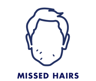 Missed Hairs in shave