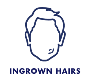 Ingrown Hairs