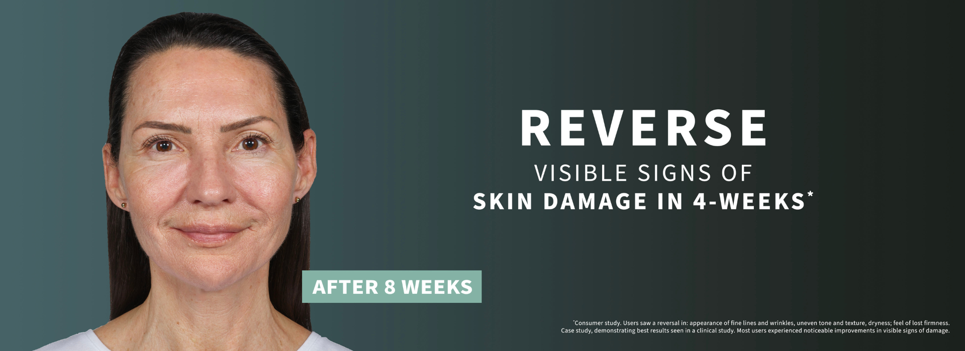 Before and after future renew. Reverse visible signs of skin damage in 4 weeks*. . *consumer study. Users saw a reversal in: appearance of finelines and wrinkles, uneven tone and texture, dryness; feel of lost firmness. Case study, demonstrating best results in a clinical study. Most users experiences noticeable improvements in visible signs of damage.