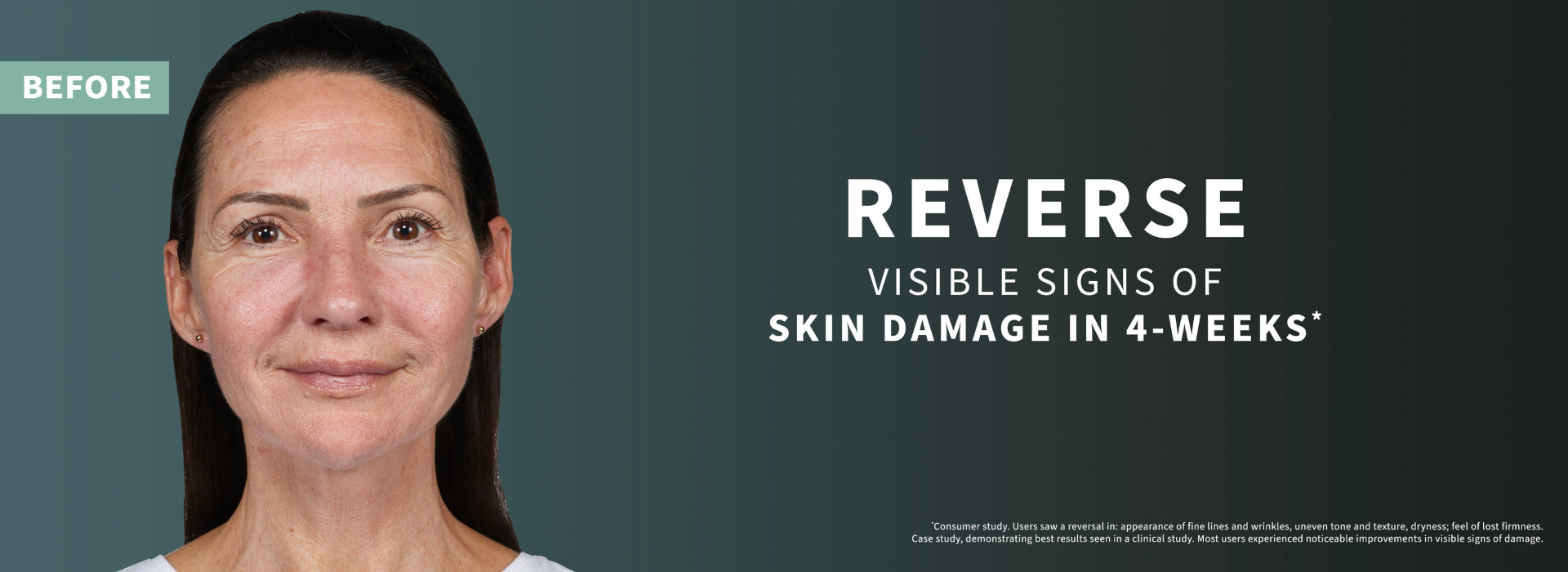 Before and after future renew. Reverse visible signs of skin damage in 4 weeks*. *consumer study. Users saw a reversal in: appearance of finelines and wrinkles, uneven tone and texture, dryness; feel of lost firmness. Case study, demonstrating best results in a clinical study. Most users experiences noticeable improvements in visible signs of damage.