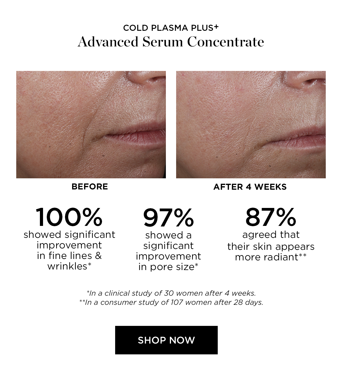 COLD PLASMA PLUS ADVANCED SERUM CONCENTRATE