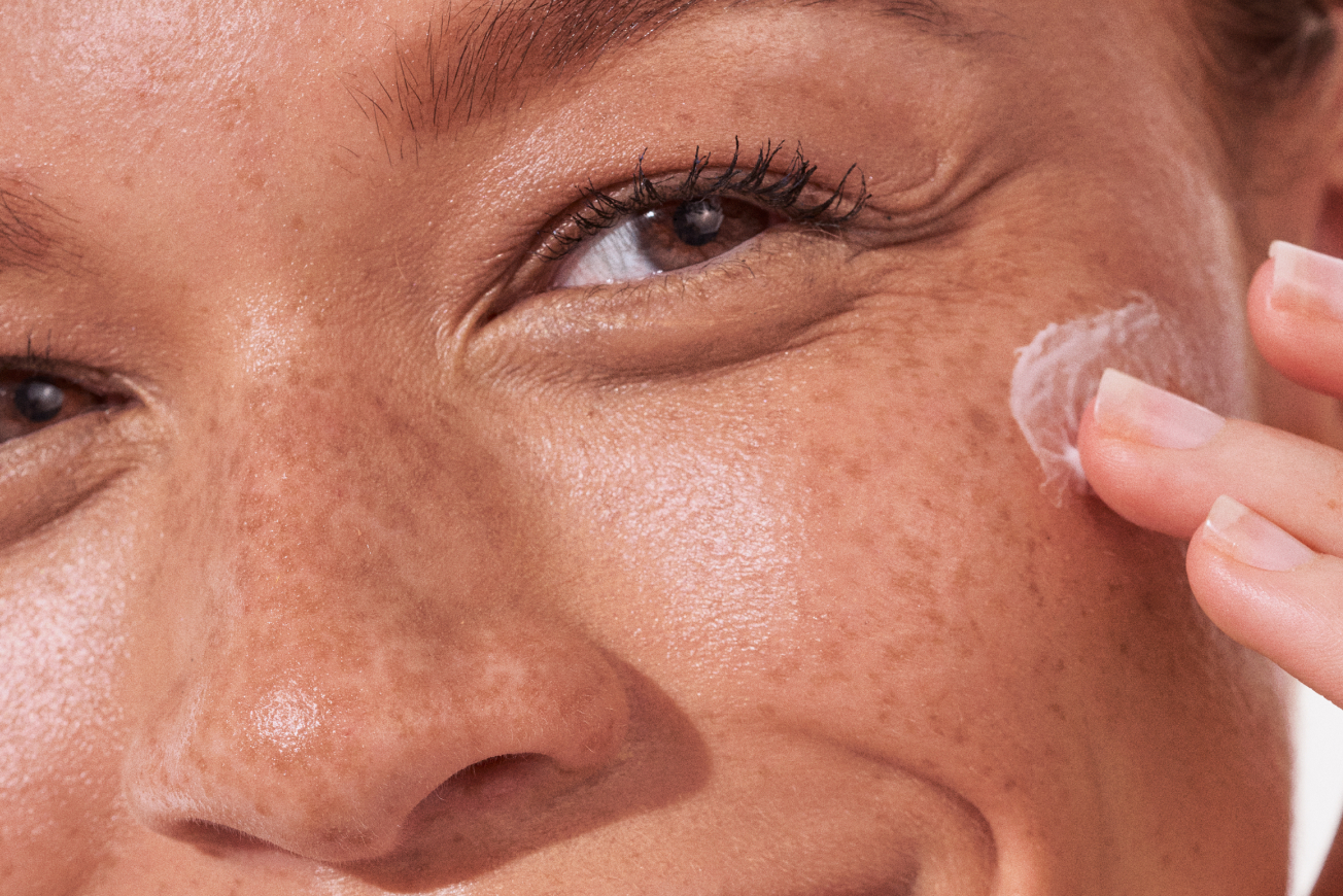 How to Get Rid of Dark Spots, A Derm Explains All