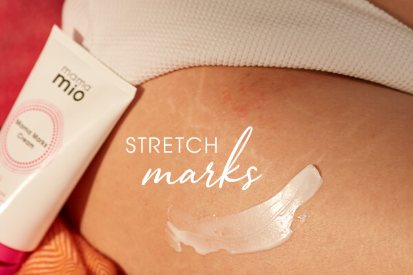 Stretch Marks