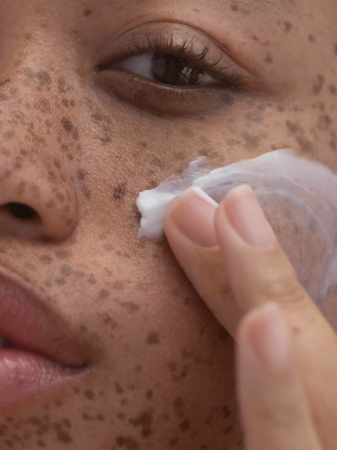 OILY SKIN