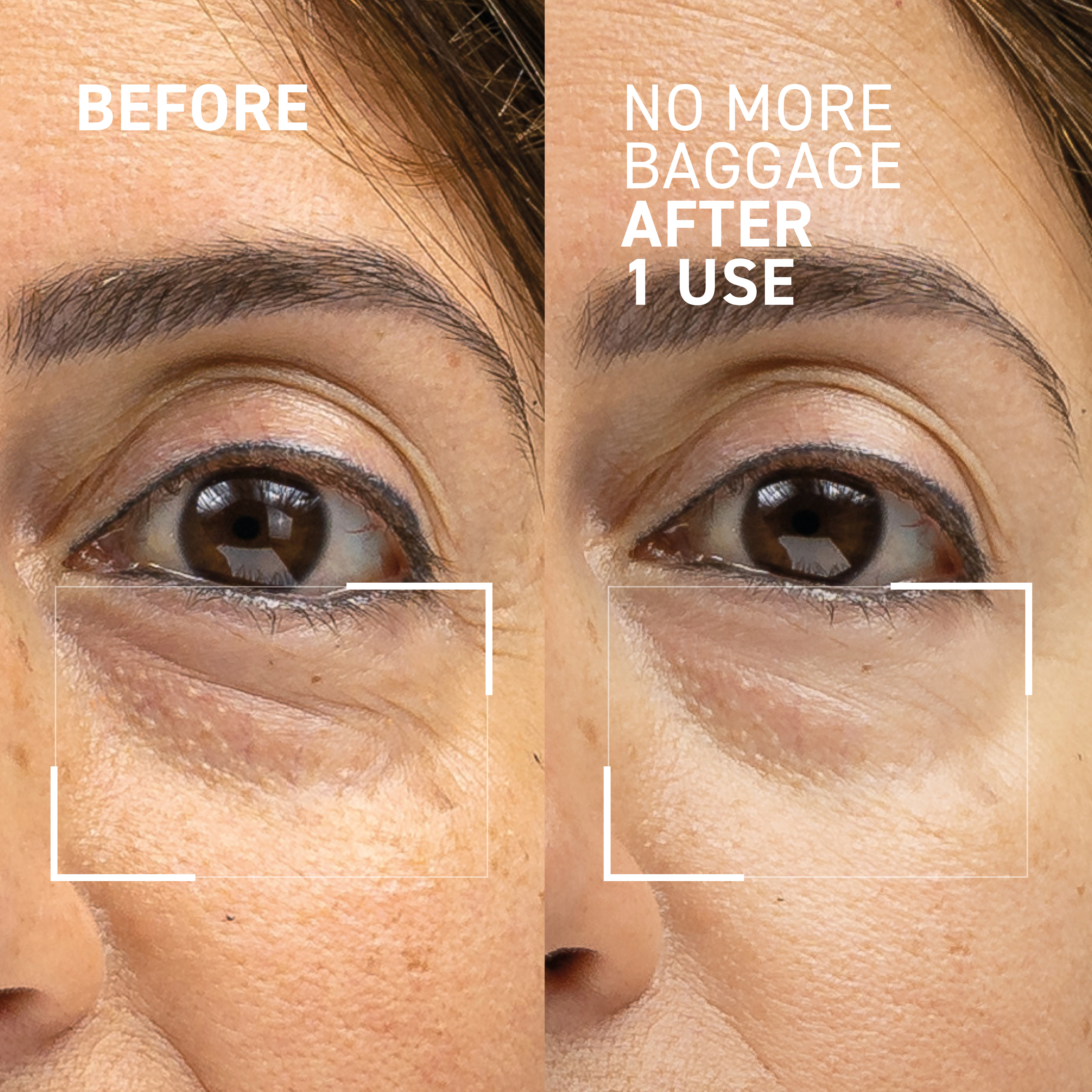 Needles No More<br>No More Baggage Eye gel